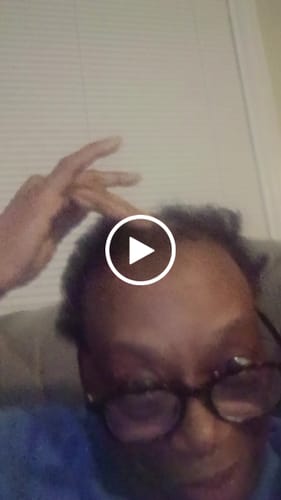 Customer video review of Rennora Hair Growth Serum