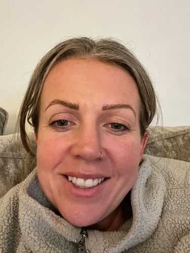 Customer photo review of Seb Natural Calming Serum