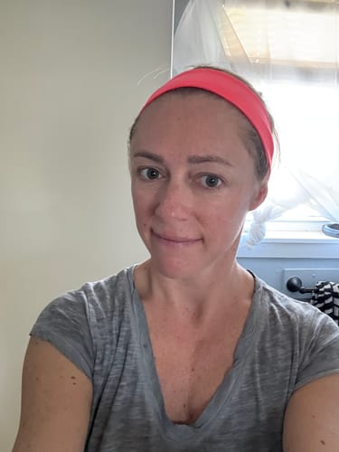 Reviewer showing their smooth forehead skin after using the Seranova Micro Infusion System.