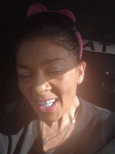 Close-up of a customer's bright smile, showing off her white Spare Veneers.