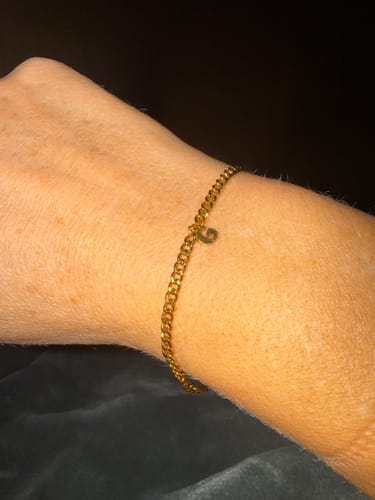 Customer photo review of Permanent Armband - dein everbond in Köln