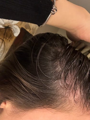 Customer photo review of Pre-Wash Fortifying Rosemary Oil for Scalp