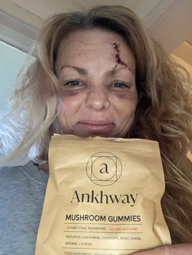 Customer photo review of Mushroom Gummies