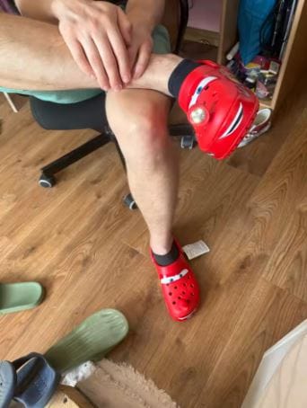 Customer photo review of SPEEDBEAM™