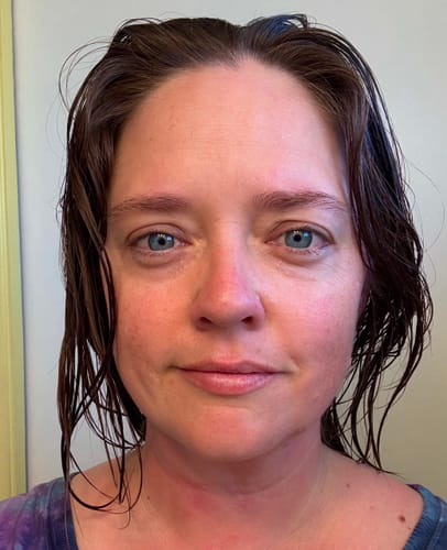 Customer's face before using the Grass Fed Tallow & Honey Balm, showing some skin redness.