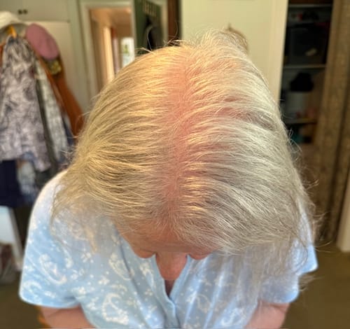Customer photo review of PEPTIDE-POWERED HAIR SERUM