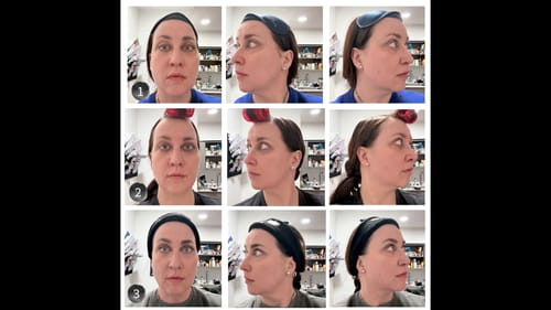 Reviewer showing skin progress in a grid of photos after three uses of The Micro Infusion System.
