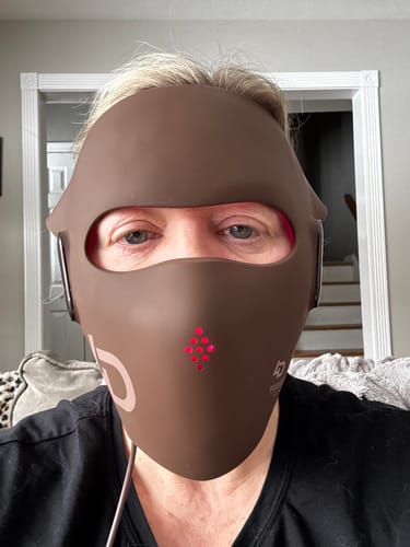 Customer photo review of JOVS 4D Laser Light Therapy Mask