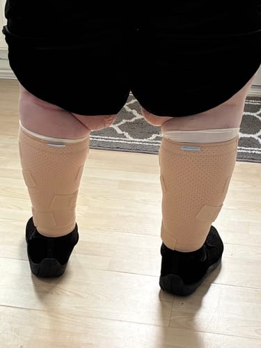 Customer photo review of Beltwell® Calf Compression Wrap