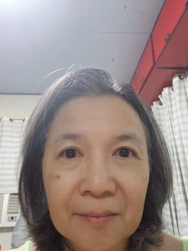 Customer selfie showing improved skin with lightened melasma after using Bad Skin™ Collagen Bomb Hydrating Ampoule.