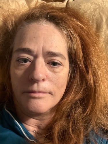 Reviewer's close-up photo of their face, showing their skin while using the Tallow & Honey Balm.