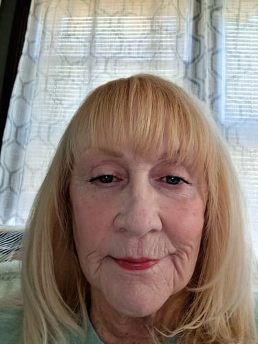 Reviewer's close-up photo showing her skin's appearance after using Deep Collagen Cream.