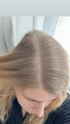 Reviewer showing their dark, ashy roots before using the Sunkissed Starter Kit.