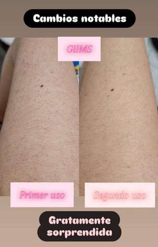 Customer photo review of GLIMS Guantes Exfoliantes