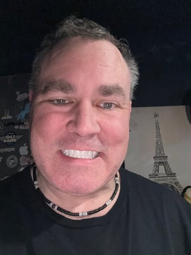 Reviewer smiling to show his bright white Pop On Veneers in a close-up photo.