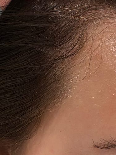 Customer photo review of Pre-Wash Fortifying Rosemary Oil for Scalp