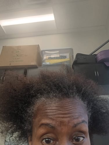 Close-up of a customer's hairline and natural hair before using the JUMBO Scalp Stimulator.