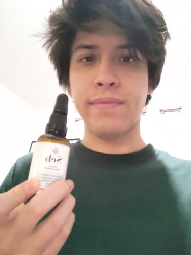 Customer photo review of Seb Natural Calming Serum