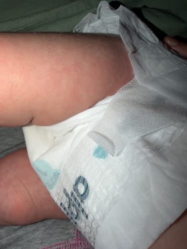 Customer photo review of Alppi Diaper Sample Pack