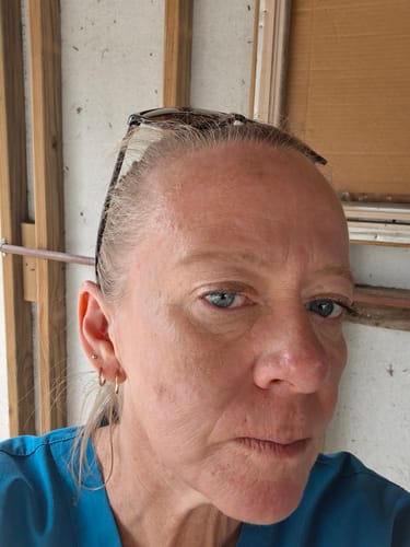 A close-up of the reviewer's face, showing their clearer skin after using the Bloat & Blemish Bundle.