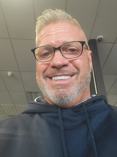 Customer showing a bright, confident smile with his new upper Pop On Veneers.