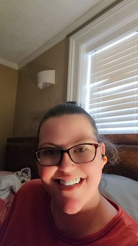 Customer smiling happily in a close-up photo, showing her bright white Pop On Veneers.