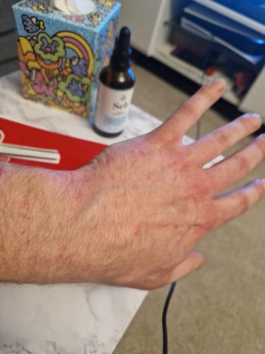 Customer photo review of Seb Natural Calming Serum