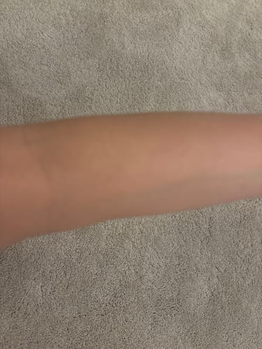 Reviewer's photo of their daughter's arm, showing smooth skin after using the Skin Saviour Balm.