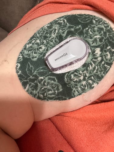 Customer photo review of Dexcom G6 Patches FINAL SALE