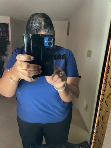 Reviewer showing their scalp and hairline, which appears fuller after using The Ultimate Growth Starter Set.