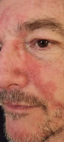 Customer photo review of Seb Natural Calming Serum