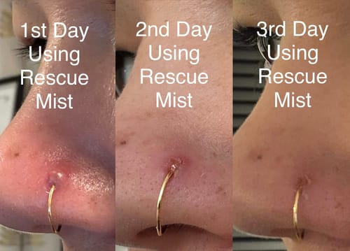Customer photo review of Rescue Mist 100ml - Bulk Discount