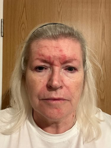 Customer photo review of Seb Natural Calming Serum