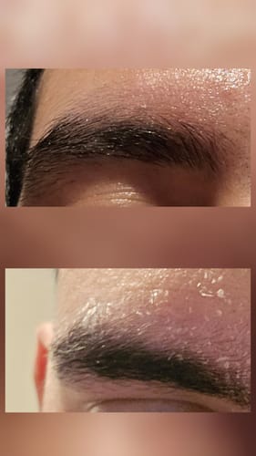 Customer photo review of Seb Natural Calming Serum