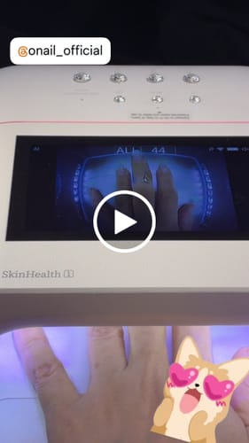 Customer video review of Skin Health No.1 AI Nail Lamp