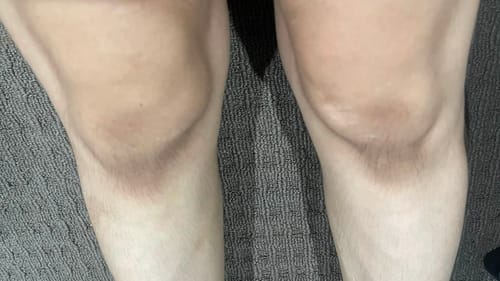 Customer photo review of Dark Spot Fader Lemongrass & Turmeric Bar