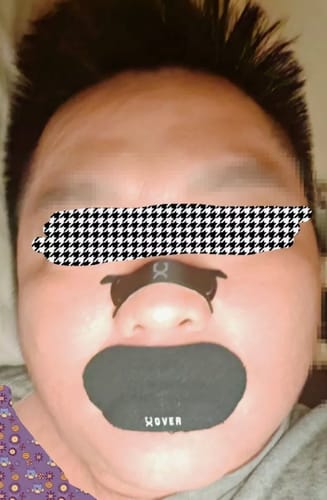 Customer photo review of OVER Nasal Strips / Mouth Tapes