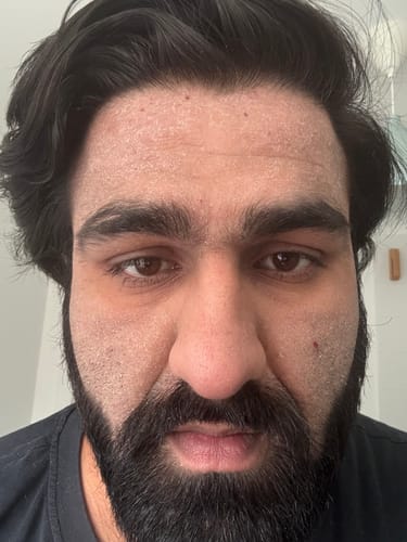 Customer photo review of Seb Natural Calming Serum