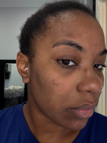 Customer photo review of Dark Spot Fader Lemongrass & Turmeric Bar