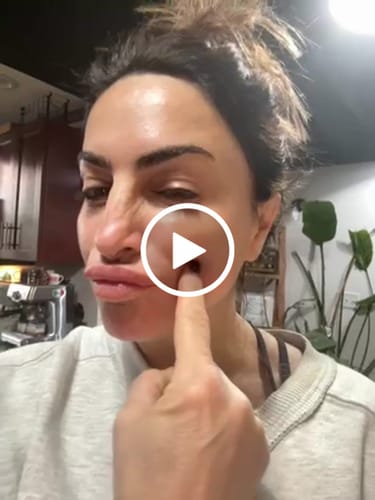 Customer video review of 3 Month Supply - Seranova Micro Infusion System