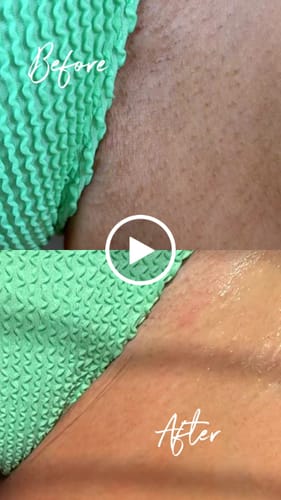 Customer video review of Superfood Intimate Care Kit