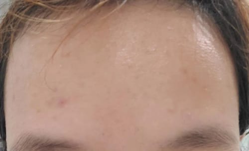Customer photo review of Collagen Night Wrapping Mask