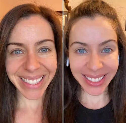 Customer photo review of Hyaluronic Acid Ultra Hydrating Serum