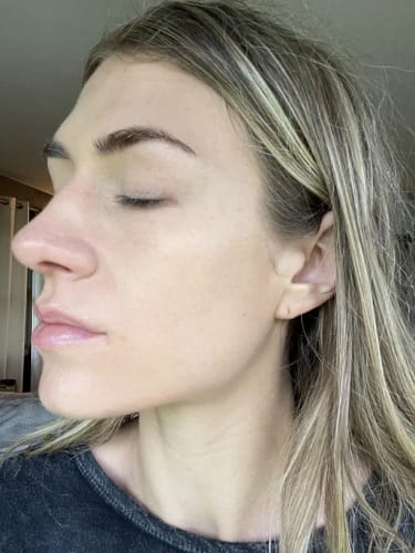 Customer photo review of Hyaluronic Acid Ultra Hydrating Serum