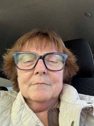 Customer shares a close-up of their face after using the Grass Fed Tallow & Honey Balm.