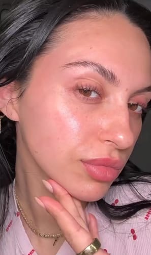 Customer photo review of Korean Hyaluronic PDRN Orb Serum