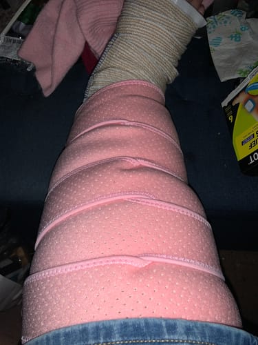 Customer photo review of Beltwell® Wide Calf Compression Wrap