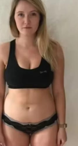 Customer photo review of Fat-Burn Secret Patch - Gewichstverlust OHNE Anstrengung