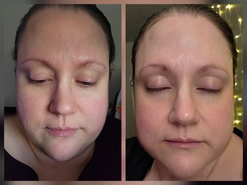 Customer photo review of EGF Blue Youth Activating Drop