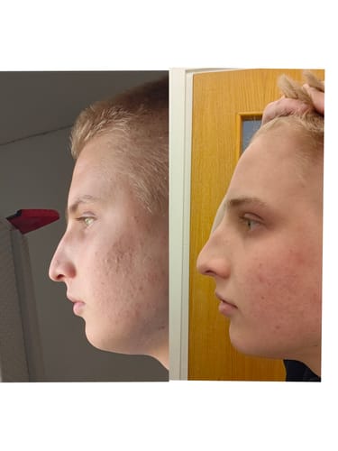 Customer photo review of JAWLINER® Fitness Chewing Gum
